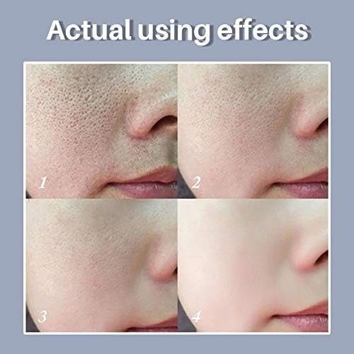 LANBENA - Pore Solution Serum